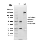SDS-PAGE - Anti-Carbonic Anhydrase IX Antibody [CA9/3407] - BSA and Azide free (A253538) - Antibodies.com