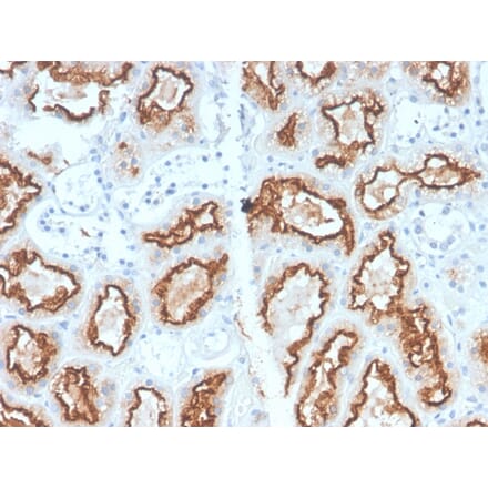 Immunohistochemistry - Anti-Carbonic Anhydrase IX Antibody [CA9/2993R] - BSA and Azide free (A253538) - Antibodies.com