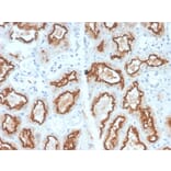 Immunohistochemistry - Anti-Carbonic Anhydrase IX Antibody [CA9/2993R] - BSA and Azide free (A253538) - Antibodies.com