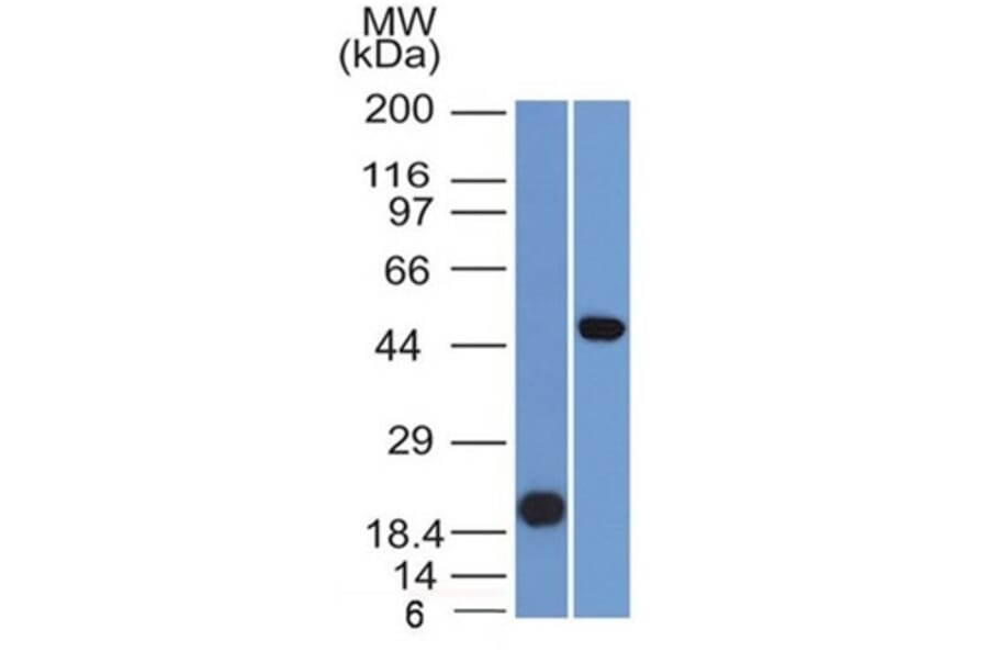 Western Blot - Anti-PAX8 Antibody [PAX8/1491] - BSA and Azide free (A253540) - Antibodies.com