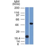 Western Blot - Anti-PAX8 Antibody [PAX8/1491] - BSA and Azide free (A253540) - Antibodies.com