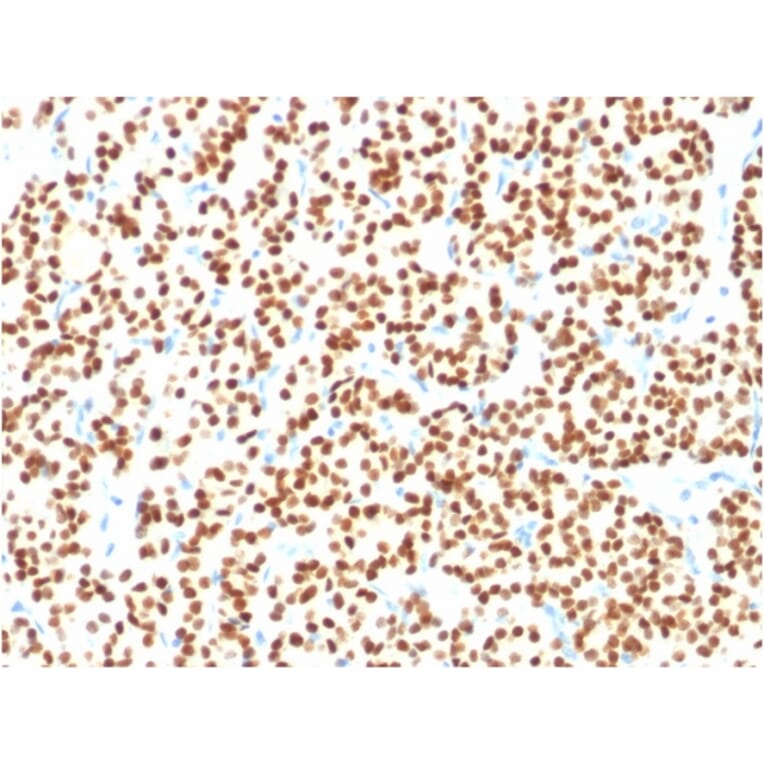 Immunohistochemistry - Anti-PAX8 Antibody [PAX8/1491] - BSA and Azide free (A253540) - Antibodies.com