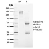 SDS-PAGE - Anti-PAX8 Antibody [PAX8/1491] - BSA and Azide free (A253540) - Antibodies.com