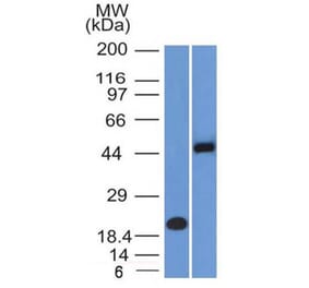 Western Blot - Anti-PAX8 Antibody [PAX8/1492] - BSA and Azide free (A253541) - Antibodies.com