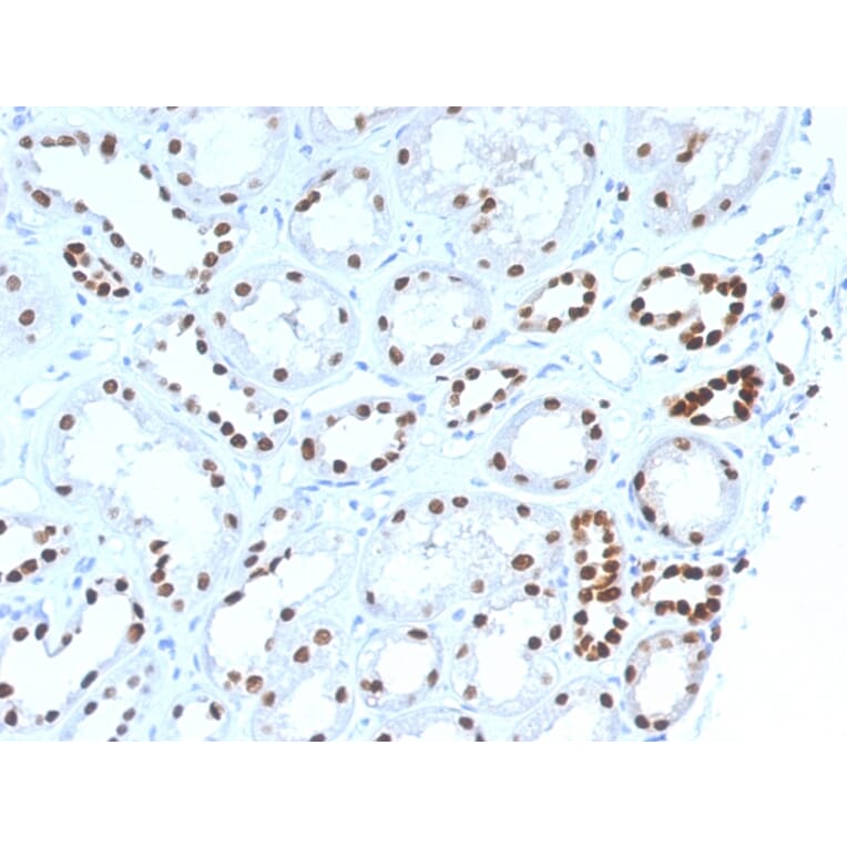 Immunohistochemistry - Anti-PAX8 Antibody [PAX8/1492] - BSA and Azide free (A253541) - Antibodies.com