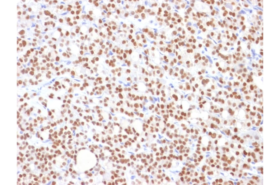 Immunohistochemistry - Anti-PAX8 Antibody [PAX8/1492] - BSA and Azide free (A253541) - Antibodies.com