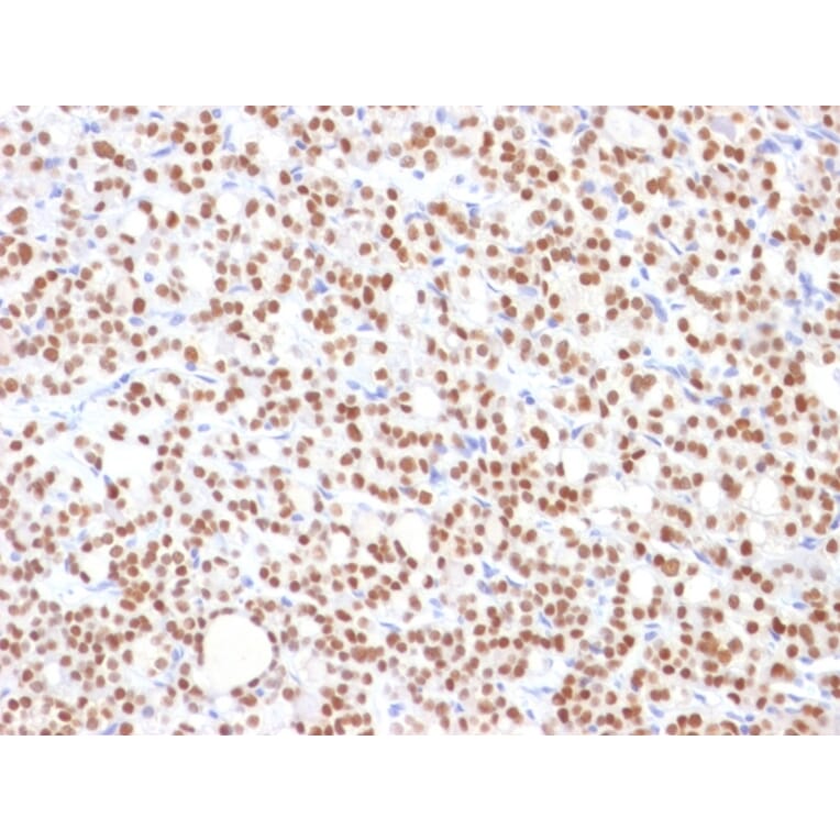 Immunohistochemistry - Anti-PAX8 Antibody [PAX8/1492] - BSA and Azide free (A253541) - Antibodies.com