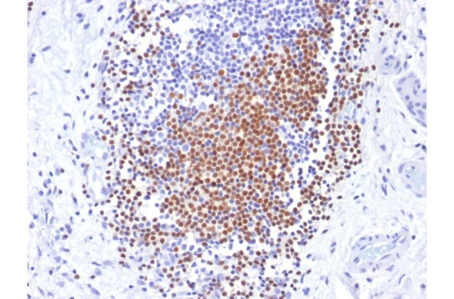 Immunohistochemistry - Anti-PAX8 Antibody [PAX8/1492] - BSA and Azide free (A253541) - Antibodies.com