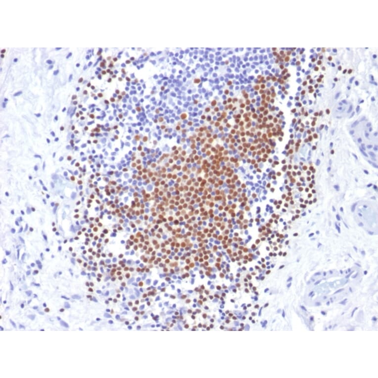 Immunohistochemistry - Anti-PAX8 Antibody [PAX8/1492] - BSA and Azide free (A253541) - Antibodies.com