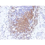 Immunohistochemistry - Anti-PAX8 Antibody [PAX8/1492] - BSA and Azide free (A253541) - Antibodies.com