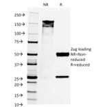 SDS-PAGE - Anti-PAX8 Antibody [PAX8/1492] - BSA and Azide free (A253541) - Antibodies.com