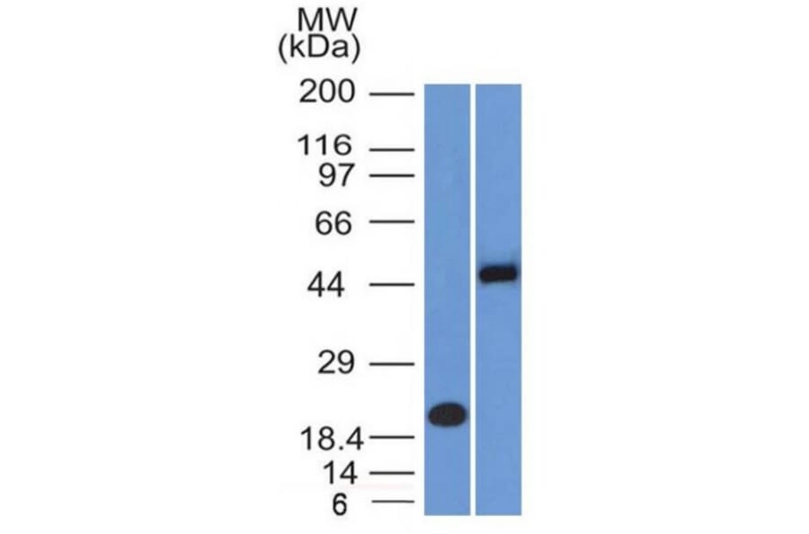 Western Blot - Anti-PAX8 Antibody [PAX8/1491 + PAX8/1492] - BSA and Azide free (A253542) - Antibodies.com