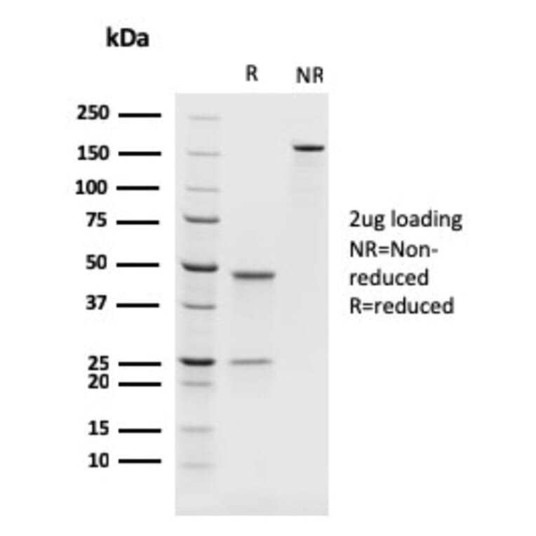 SDS-PAGE - Anti-PAX8 Antibody [rPAX8/1492] - BSA and Azide free (A253543) - Antibodies.com