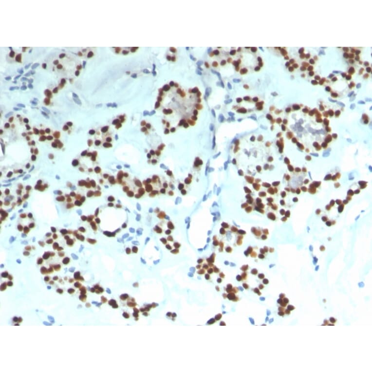 Immunohistochemistry - Anti-PAX8 Antibody [rPAX8/1492] - BSA and Azide free (A253542) - Antibodies.com