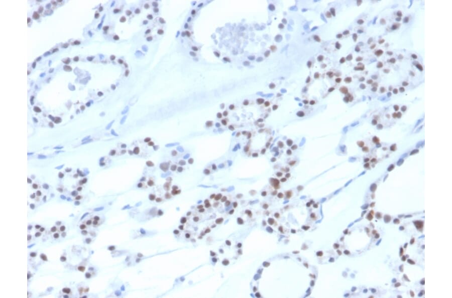 Immunohistochemistry - Anti-PAX8 Antibody [rPAX8/3687] - BSA and Azide free (A253543) - Antibodies.com