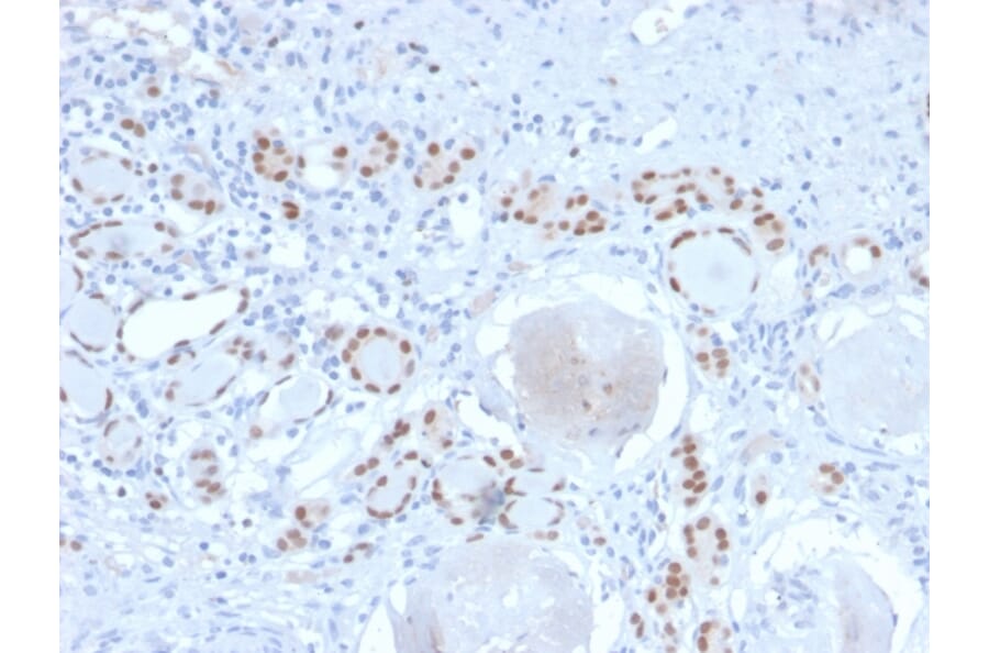 Immunohistochemistry - Anti-PAX8 Antibody [PAX8/2774R] - BSA and Azide free (A253544) - Antibodies.com