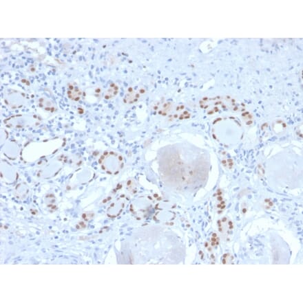 Immunohistochemistry - Anti-PAX8 Antibody [PAX8/2774R] - BSA and Azide free (A253544) - Antibodies.com