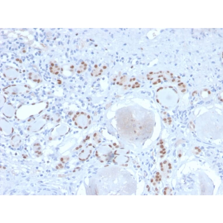Immunohistochemistry - Anti-PAX8 Antibody [PAX8/2774R] - BSA and Azide free (A253544) - Antibodies.com