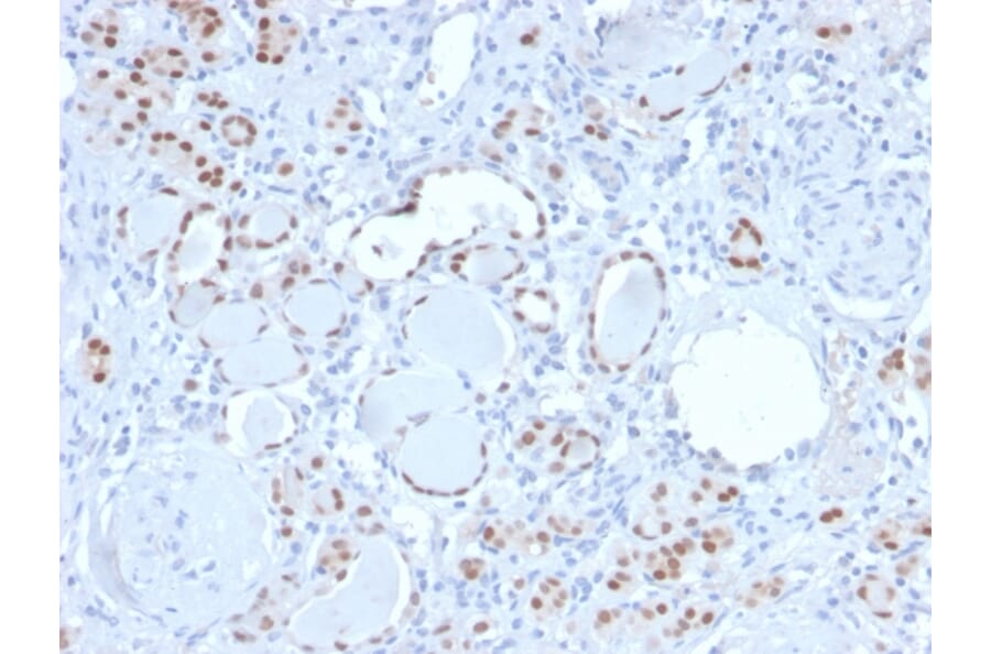Immunohistochemistry - Anti-PAX8 Antibody [PAX8/3688R] - BSA and Azide free (A253545) - Antibodies.com