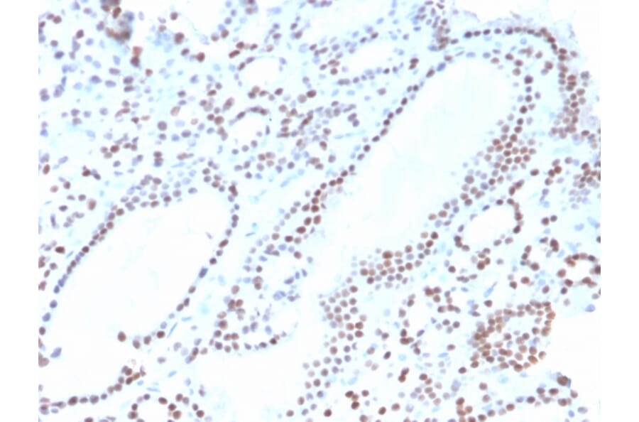 Immunohistochemistry - Anti-PAX8 Antibody [ZR-1] - BSA and Azide free (A253547) - Antibodies.com