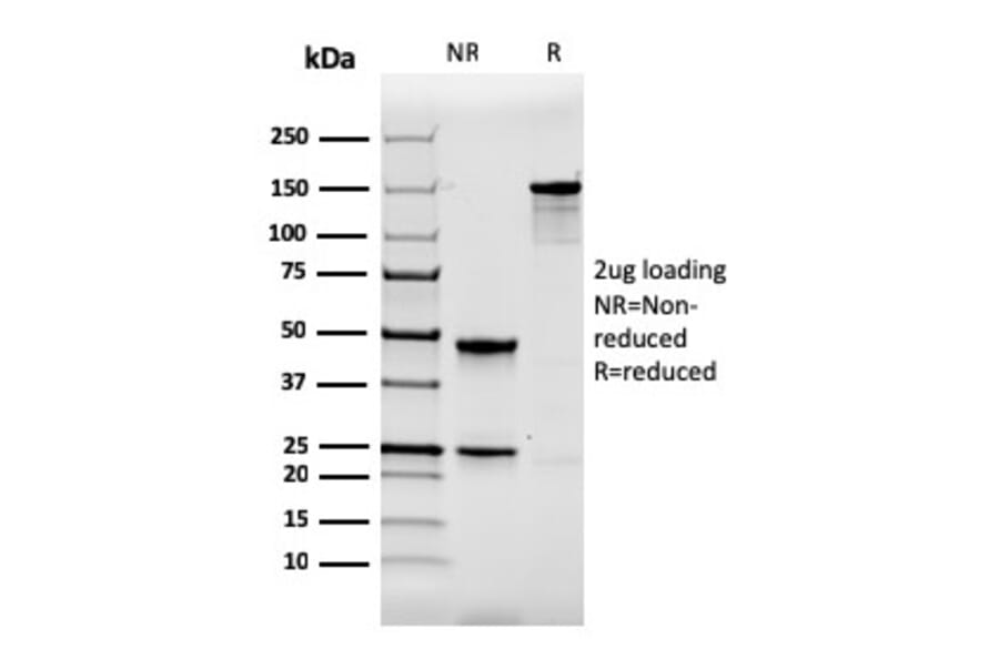 SDS-PAGE - Anti-Calbindin Antibody [CALB1/2364] - BSA and Azide free (A253549) - Antibodies.com