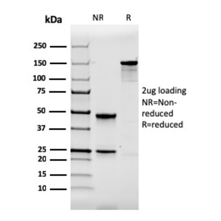 SDS-PAGE - Anti-Calbindin Antibody [CALB1/2364] - BSA and Azide free (A253549) - Antibodies.com