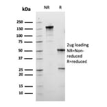 SDS-PAGE - Anti-Calbindin Antibody [CALB1/3333] - BSA and Azide free (A253551) - Antibodies.com