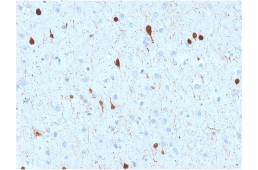 Immunohistochemistry - Anti-Calretinin Antibody [CALB2/2602] - BSA and Azide free (A253552) - Antibodies.com