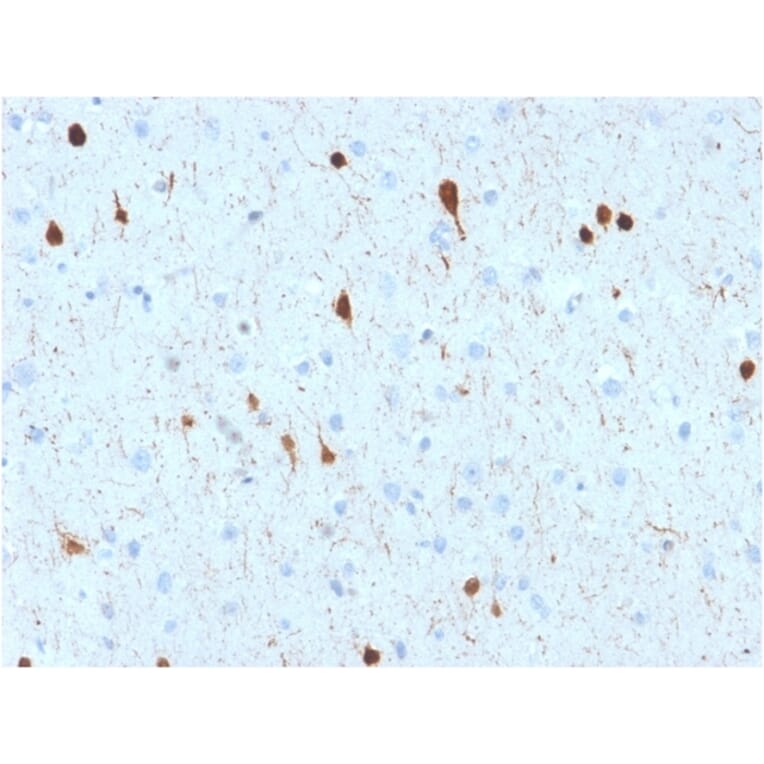 Immunohistochemistry - Anti-Calretinin Antibody [CALB2/2602] - BSA and Azide free (A253552) - Antibodies.com