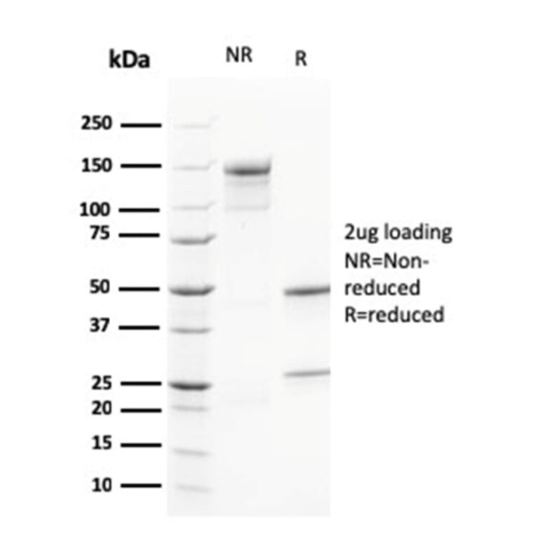 SDS-PAGE - Anti-Calretinin Antibody [CALB2/2602] - BSA and Azide free (A253552) - Antibodies.com