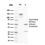 SDS-PAGE - Anti-Calretinin Antibody [CALB2/2602] - BSA and Azide free (A253552) - Antibodies.com