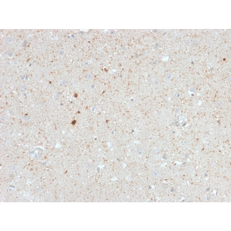 Immunohistochemistry - Anti-Calretinin Antibody [CALB2/2603] - BSA and Azide free (A253553) - Antibodies.com