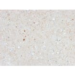 Immunohistochemistry - Anti-Calretinin Antibody [CALB2/2603] - BSA and Azide free (A253553) - Antibodies.com