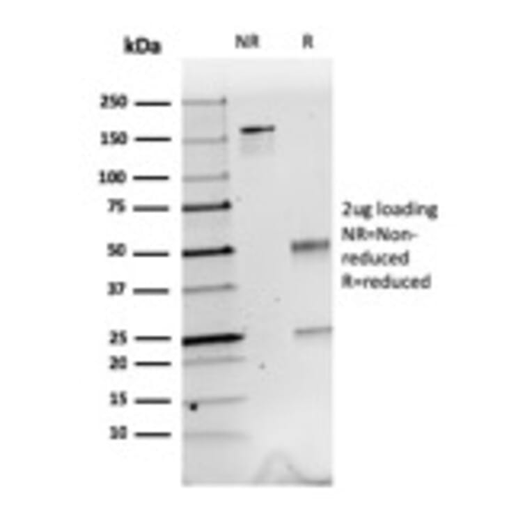 SDS-PAGE - Anti-Calretinin Antibody [CALB2/2603] - BSA and Azide free (A253553) - Antibodies.com