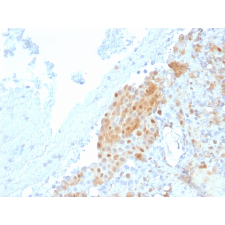 Immunohistochemistry - Anti-Calretinin Antibody [CALB2/2685] - BSA and Azide free (A253554) - Antibodies.com