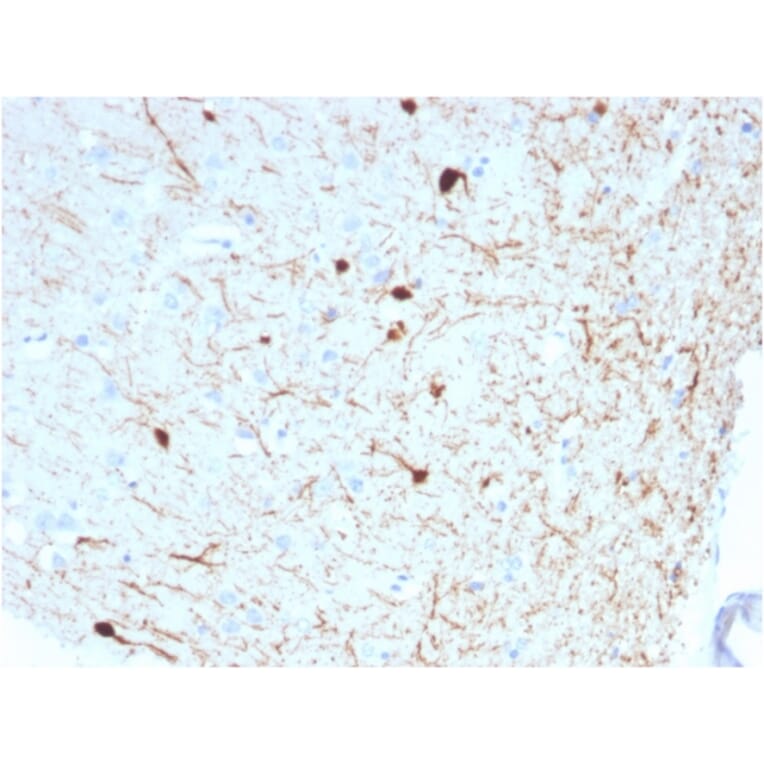 Immunohistochemistry - Anti-Calretinin Antibody [CALB2/2786] - BSA and Azide free (A253555) - Antibodies.com