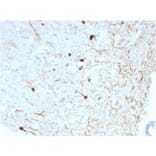 Immunohistochemistry - Anti-Calretinin Antibody [CALB2/2786] - BSA and Azide free (A253555) - Antibodies.com
