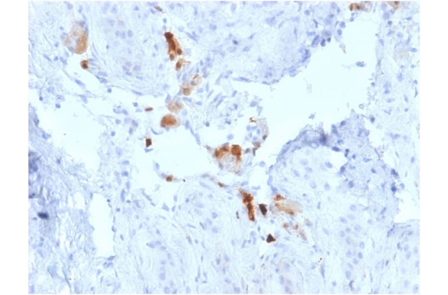 Immunohistochemistry - Anti-Calretinin Antibody [CALB2/2786] - BSA and Azide free (A253555) - Antibodies.com
