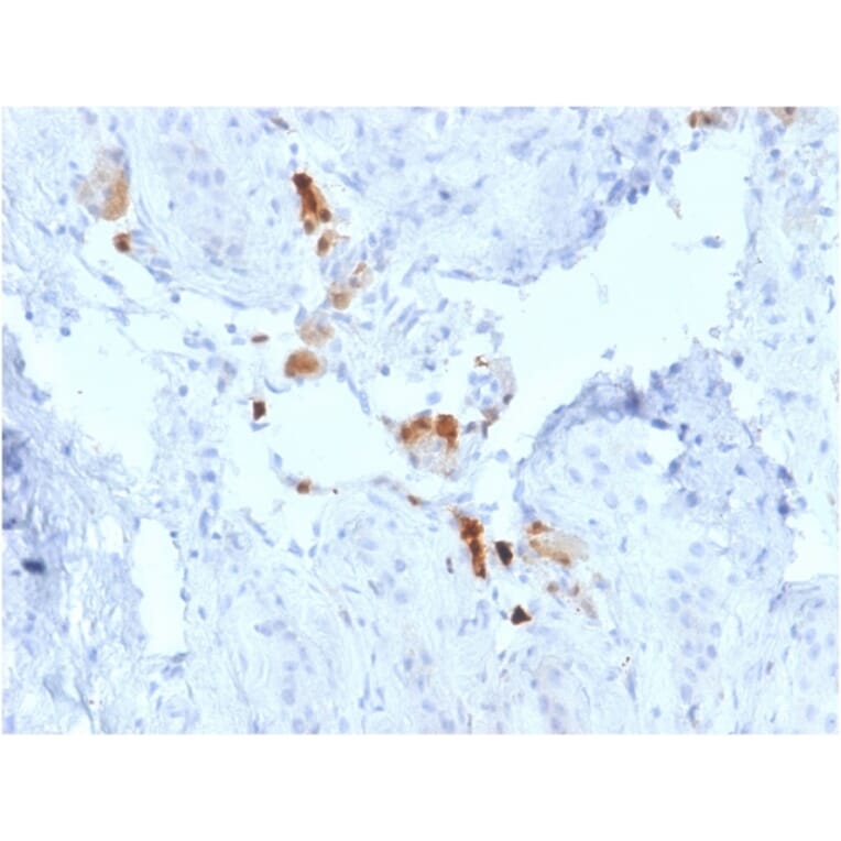 Immunohistochemistry - Anti-Calretinin Antibody [CALB2/2786] - BSA and Azide free (A253555) - Antibodies.com