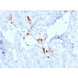 Immunohistochemistry - Anti-Calretinin Antibody [CALB2/2786] - BSA and Azide free (A253555) - Antibodies.com