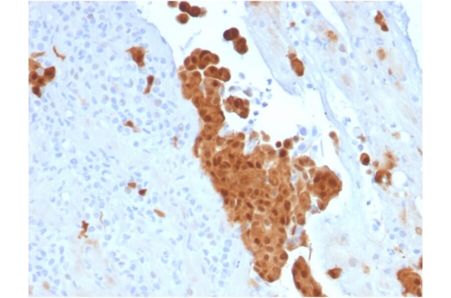 Immunohistochemistry - Anti-Calretinin Antibody [CALB2/2786] - BSA and Azide free (A253555) - Antibodies.com