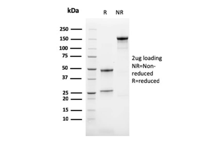 SDS-PAGE - Anti-Calretinin Antibody [CALB2/2786] - BSA and Azide free (A253555) - Antibodies.com