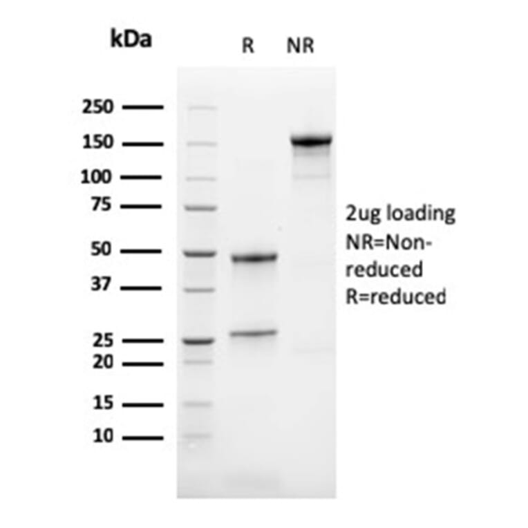 SDS-PAGE - Anti-Calretinin Antibody [CALB2/2786] - BSA and Azide free (A253555) - Antibodies.com
