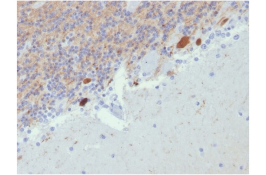 Immunohistochemistry - Anti-Calretinin Antibody [CALB2/2807] - BSA and Azide free (A253556) - Antibodies.com
