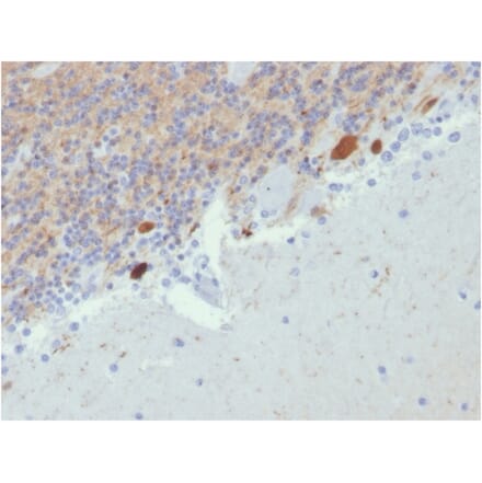 Immunohistochemistry - Anti-Calretinin Antibody [CALB2/2807] - BSA and Azide free (A253556) - Antibodies.com
