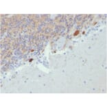 Immunohistochemistry - Anti-Calretinin Antibody [CALB2/2807] - BSA and Azide free (A253556) - Antibodies.com