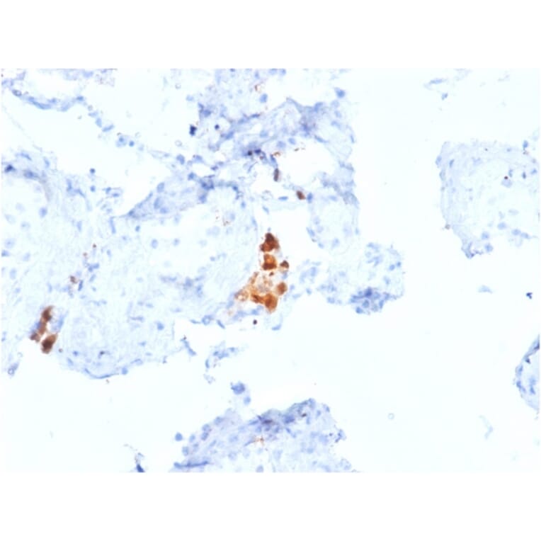 Immunohistochemistry - Anti-Calretinin Antibody [CALB2/2807] - BSA and Azide free (A253556) - Antibodies.com