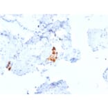 Immunohistochemistry - Anti-Calretinin Antibody [CALB2/2807] - BSA and Azide free (A253556) - Antibodies.com