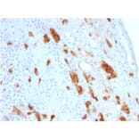 Immunohistochemistry - Anti-Calretinin Antibody [CALB2/2807] - BSA and Azide free (A253556) - Antibodies.com