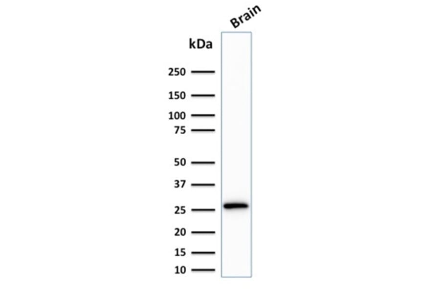 Western Blot - Anti-Calretinin Antibody [CALB2/2807] - BSA and Azide free (A253556) - Antibodies.com
